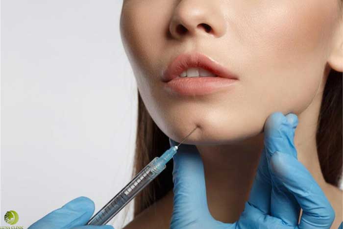 بوتاکس چانه 