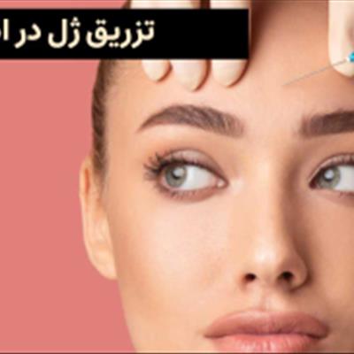 تزریق ژل اصفهان
