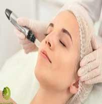 میکرونیدلینگ در اصفهان | 09190231250