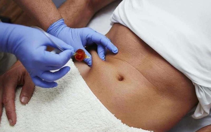 مزوتراپی لاغری کلينيک دکتر مهسا يزدخواستی اصفهان