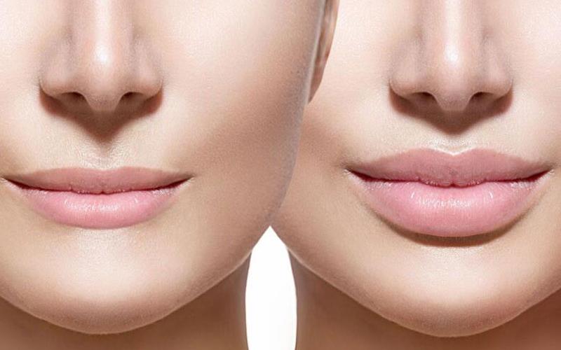 ژل لب روسی در اصفهان