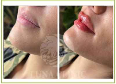 مزوژل جوانساز 09190231250💫